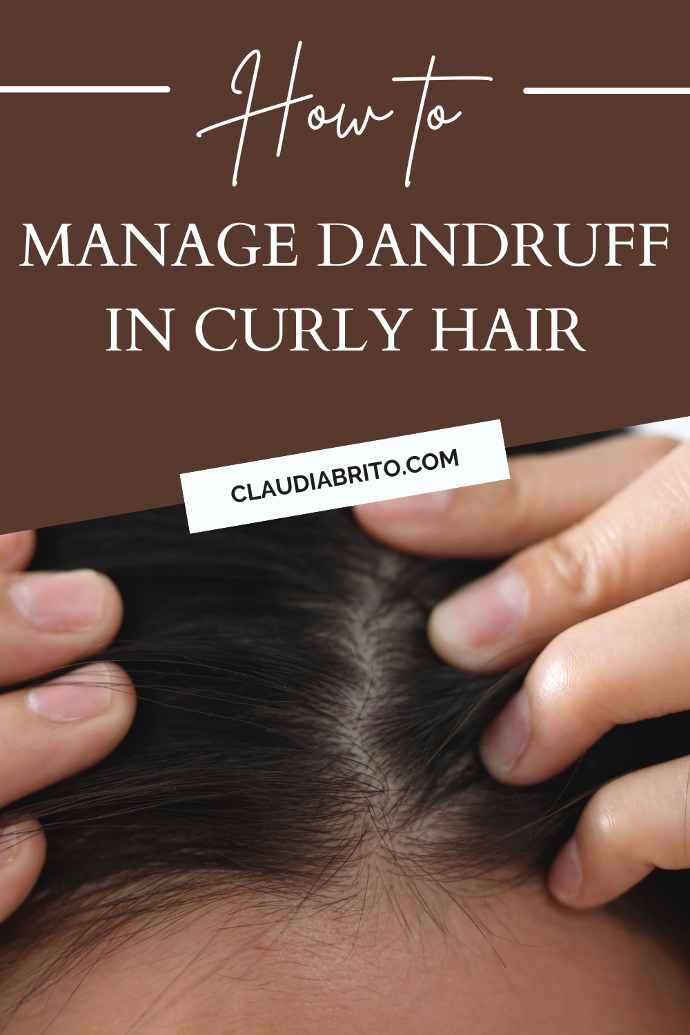 How to Manage Dandruff in Curly Hair: Expert Tips for a Healthy Scalp and Defined Curls